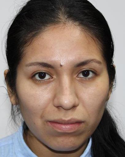 Rosmery Huamani Acosta