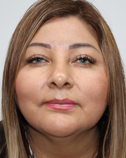 Yvon Carolina Baldeon Quispe